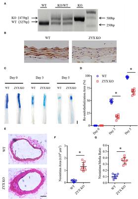 Zyxin Mediates Vascular Repair via Endothelial Migration Promoted by Forskolin in Mice